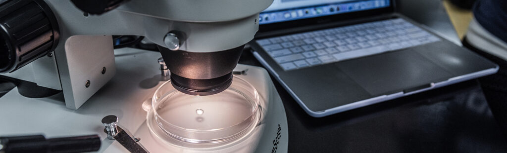 Beneath the lense of a microscope, a petri dish is illuminated by the microscope’s light.