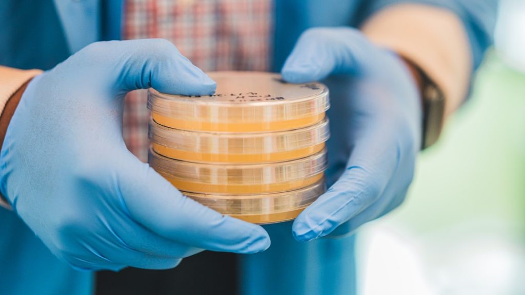 Two gloved hands holding petri dishes in lab.