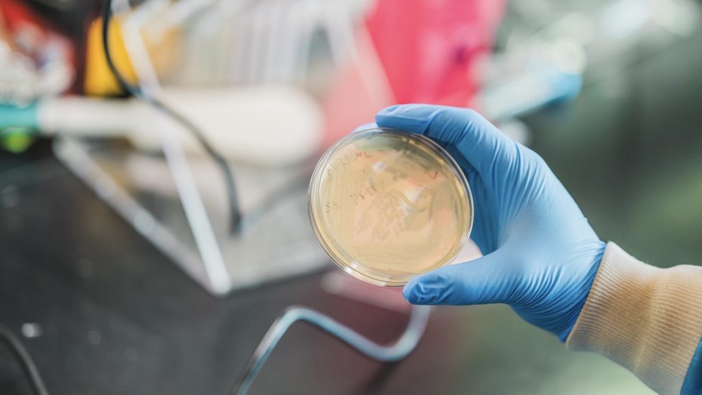 Hand wearing a blue latex glove holding a petri dish in a laboratory setting.